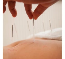 Acupuntura - Para el dolor - Pilar Fernández Huertas